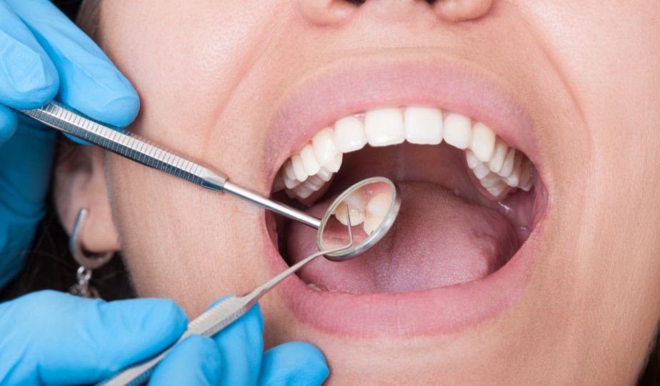 Oral Health Promotion Talk Event
